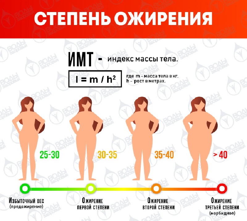 Степень ожирения по росту. Степени ожирения. Степень ожирения по индексу массы тела. Степени ожирения по ИМТ. Стадии ожирения у женщин.